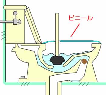 トイレのつまりを直すためにラバーカップ（スッポン）を使用するときに、トイレの便座にゴミ袋などのビニールをかぶせる理由と手順を解説しています。